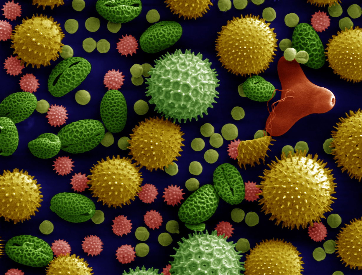 Imagen de microscopio electrónico coloreada con granos de polen de formas y texturas distintas: esferas con púas, óvalos lisos y granos con surcos