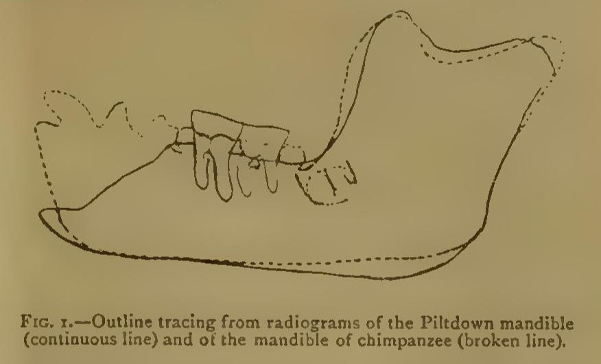 Lámina científica de 1913 con dibujos de la mandíbula de Piltdown vista desde varios ángulos