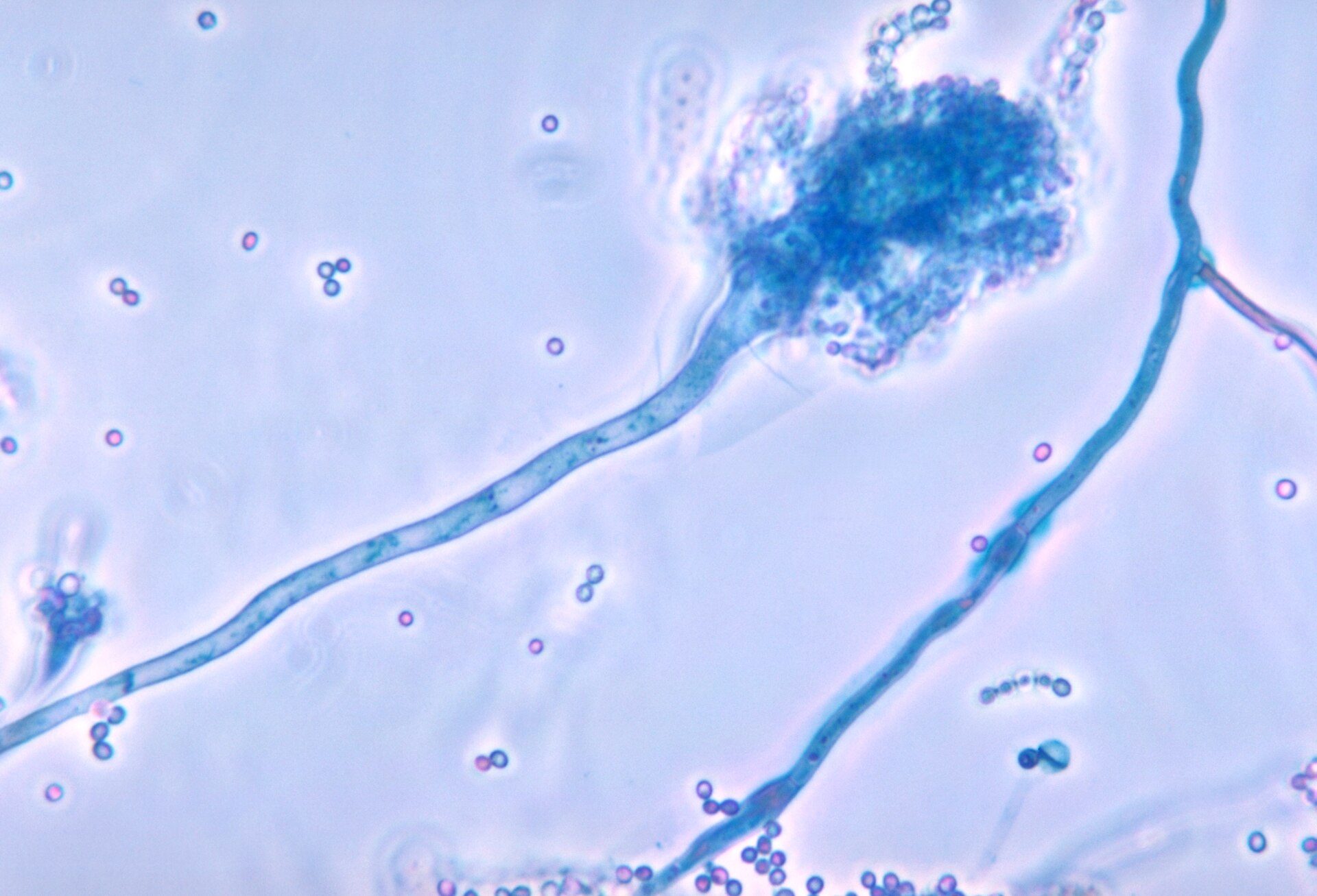 Fotografía al microscopio de un moho, con un tallo que termina en una cabeza redonda de la que salen cadenas de esporas