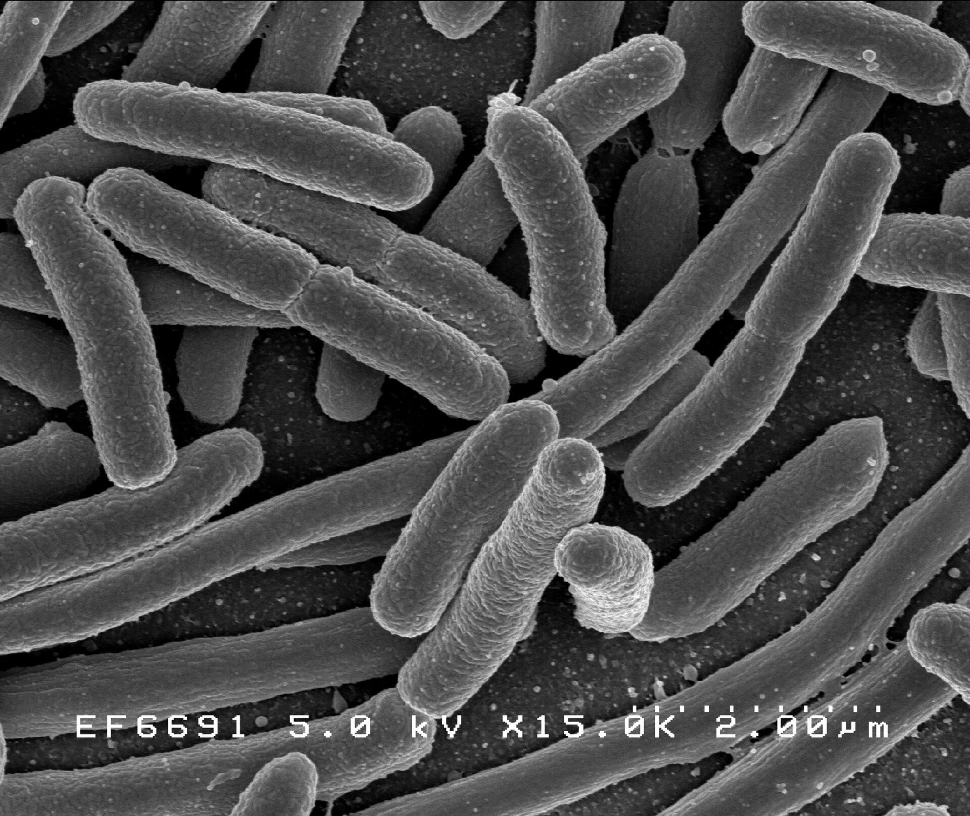 Imagen de microscopio electrónico de varias bacterias alargadas, con forma de bastón, sobre un fondo liso