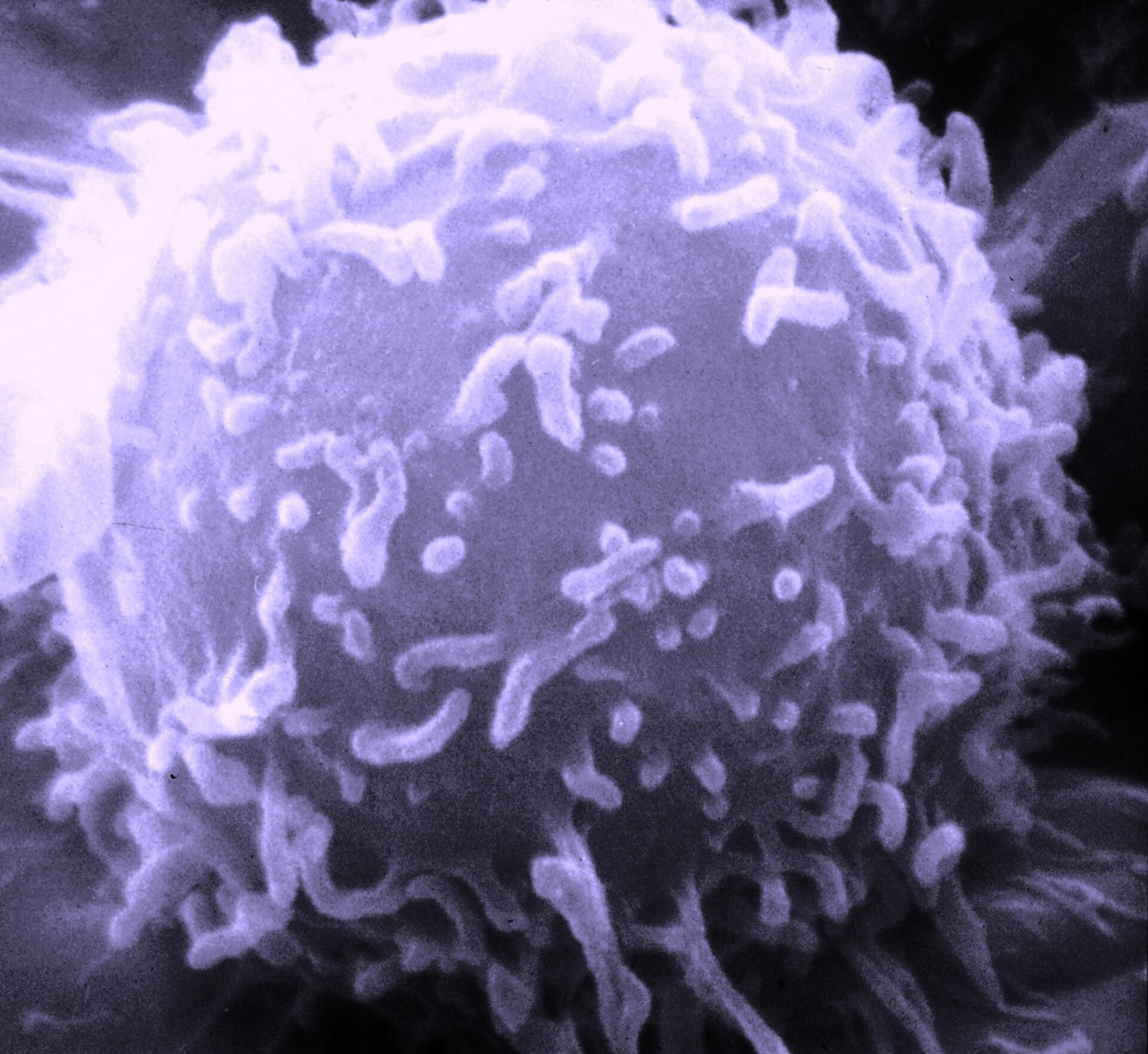 Imagen de microscopio electrónico de una célula redonda y rugosa sobre un fondo liso
