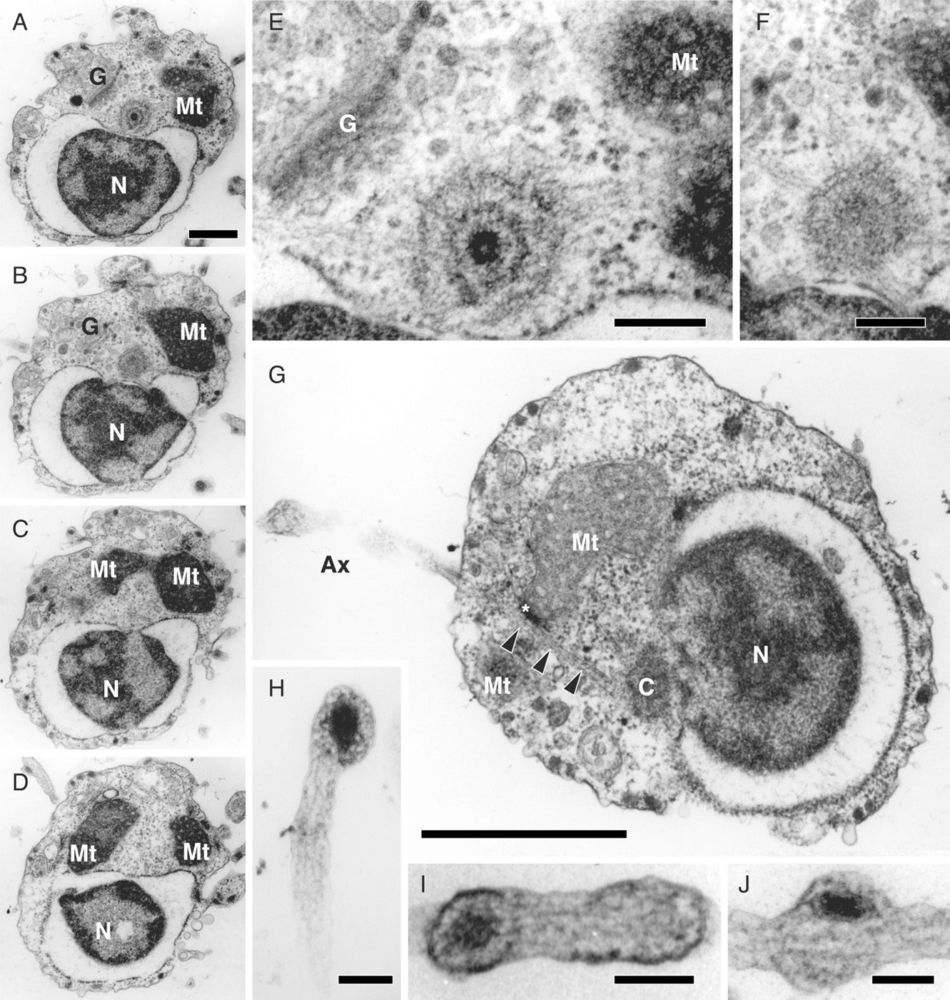 Micrografías electrónicas en blanco y negro de una célula, con varias mitocondrias alargadas en las que se ven los pliegues internos