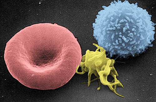 Imagen coloreada de microscopio electrónico con un glóbulo rojo en forma de disco, una plaqueta pequeña y un glóbulo blanco redondo y rugoso