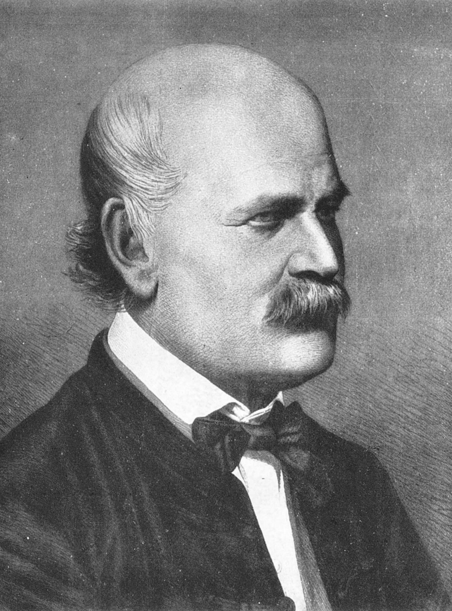 Retrato fotográfico de Ignaz Semmelweis hacia 1860, con patillas y levita