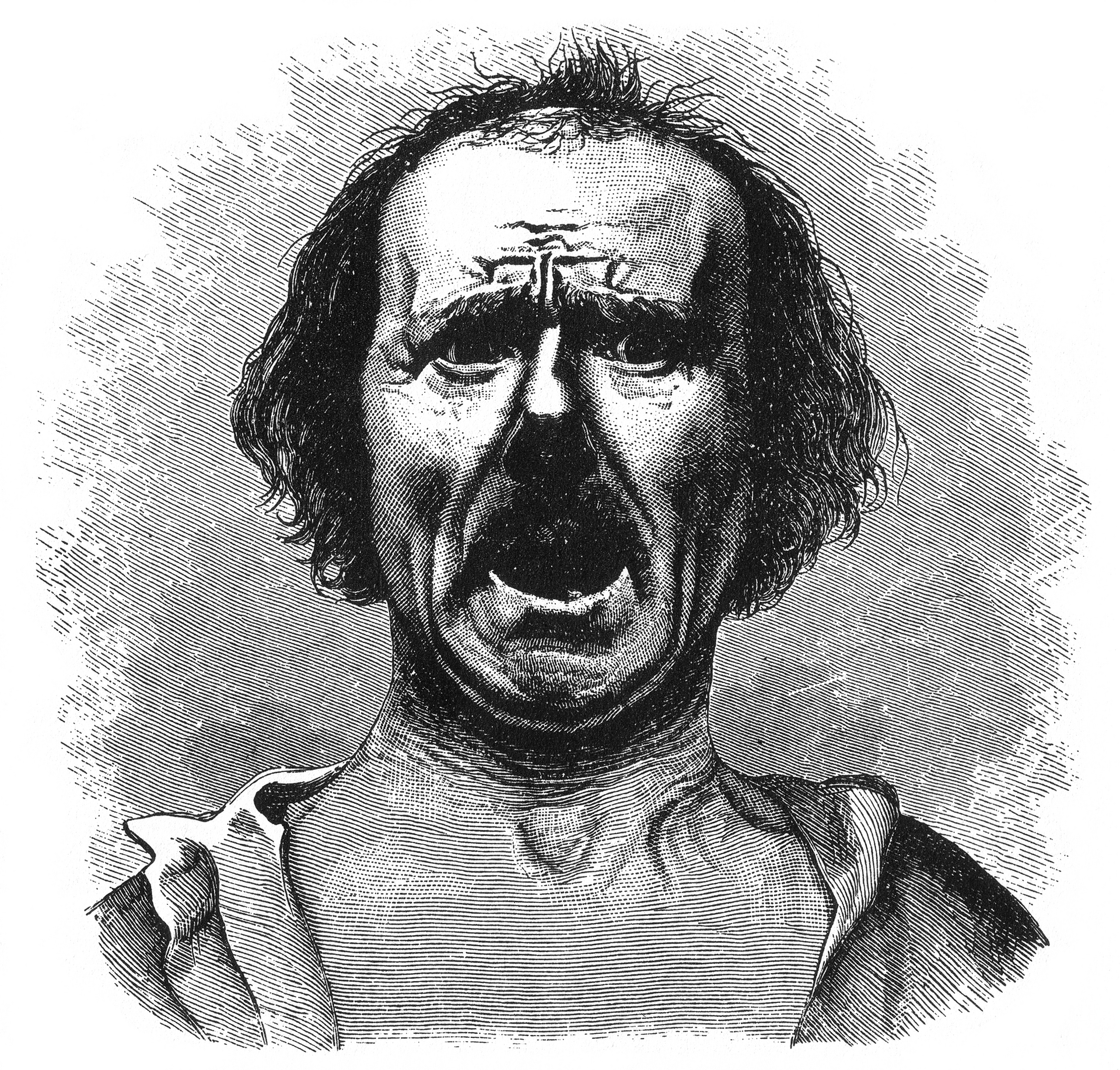 Grabado de 1872 que reproduce la fotografía de un rostro masculino contraído en una expresión extrema de horror y agonía